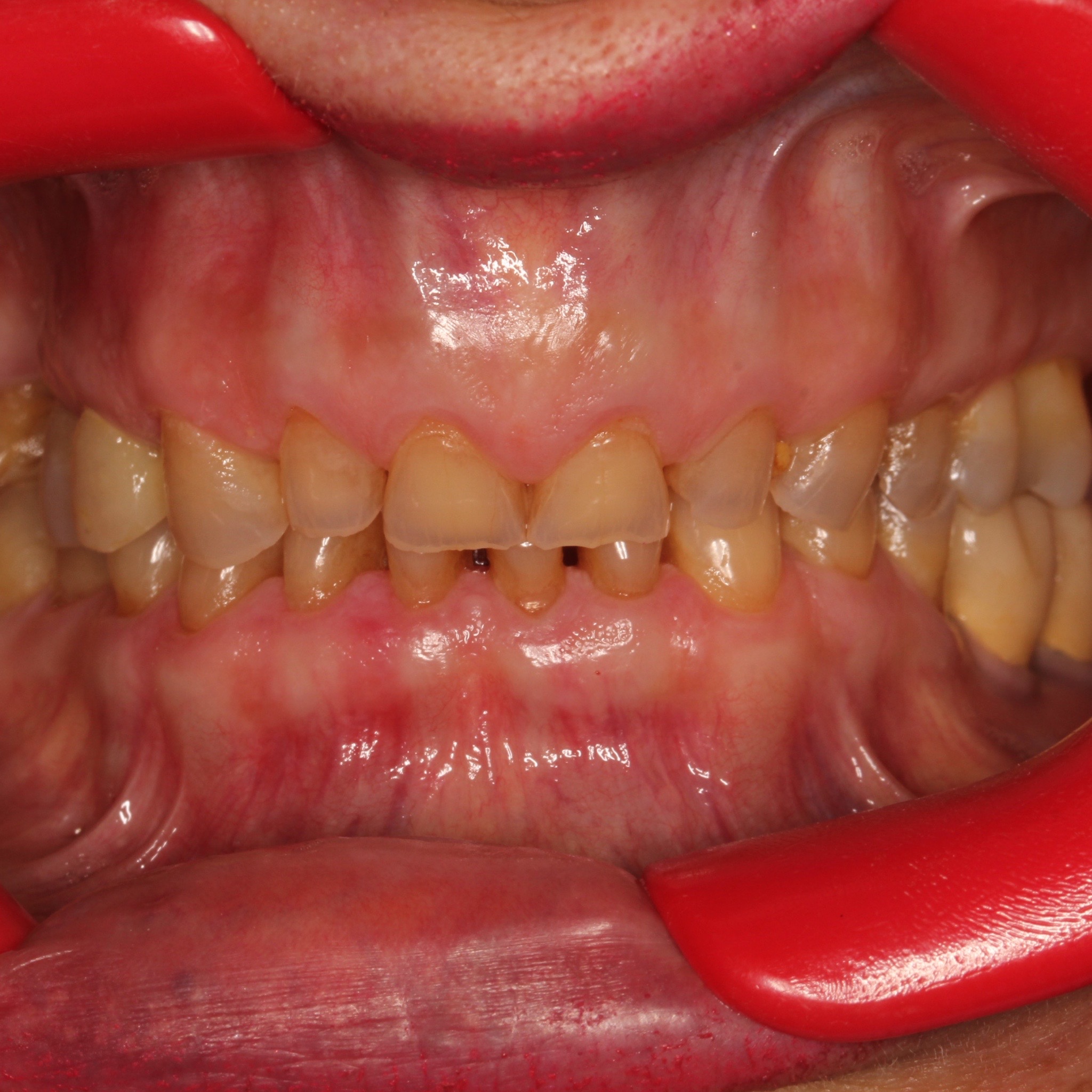 photo_before
