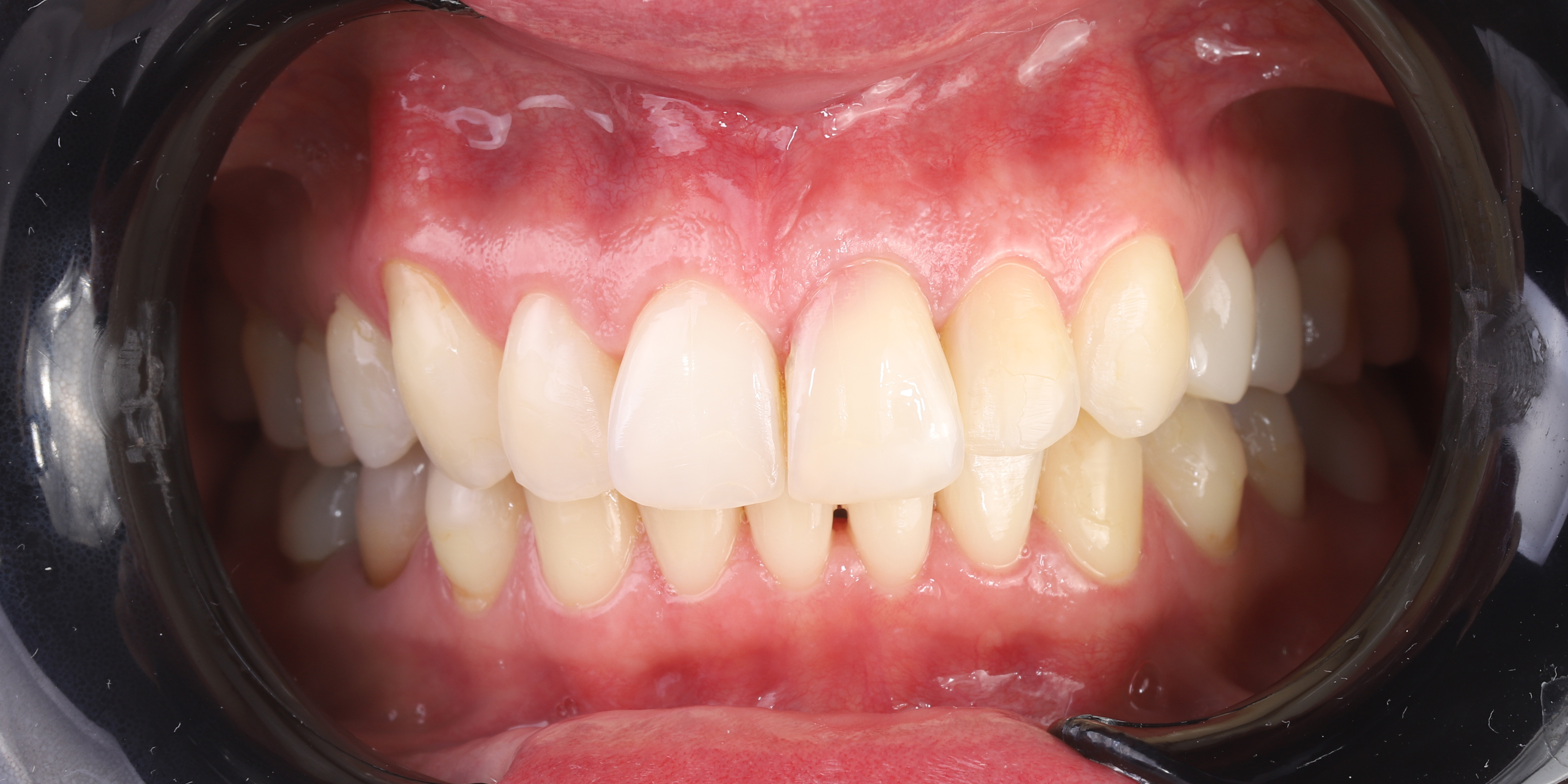photo_before