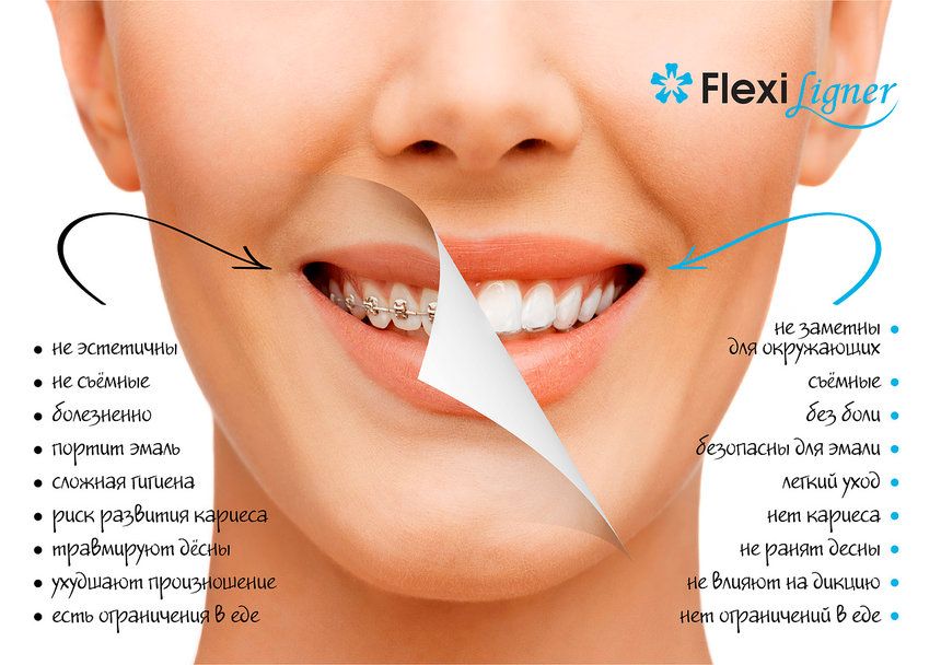 Flexiligner