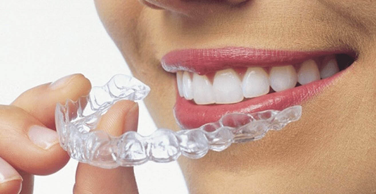 3D smile