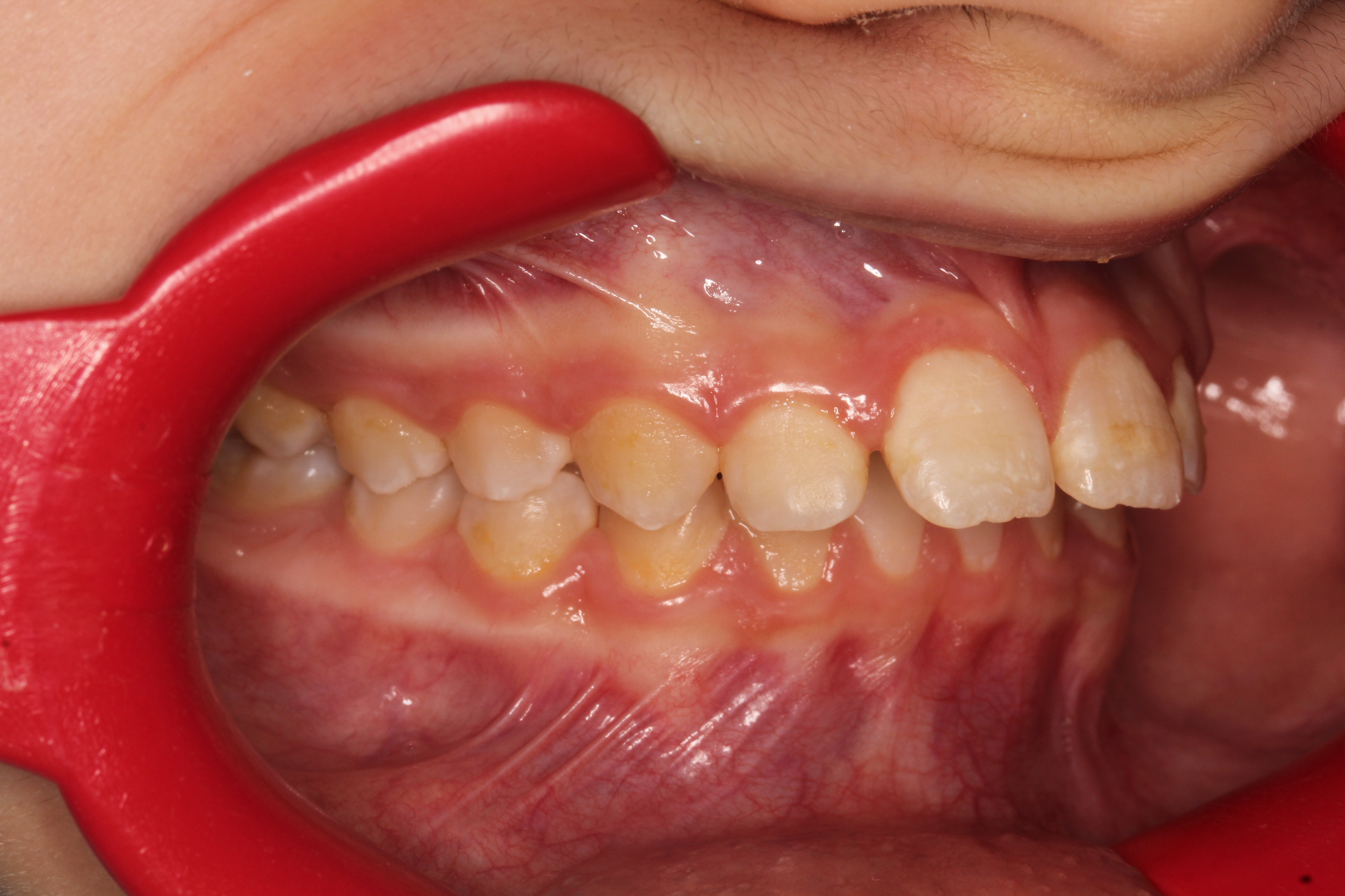 photo_before