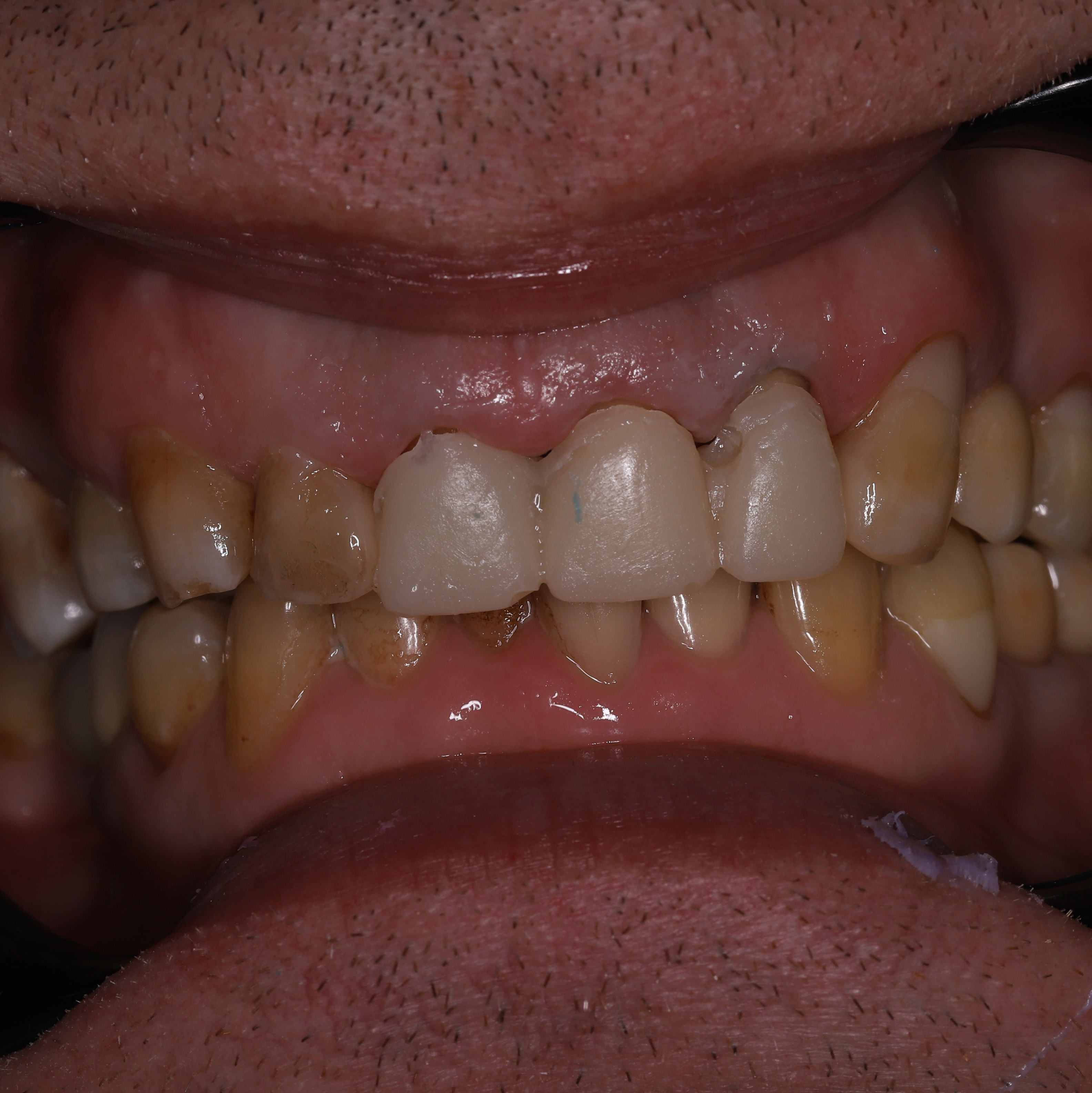 photo_before