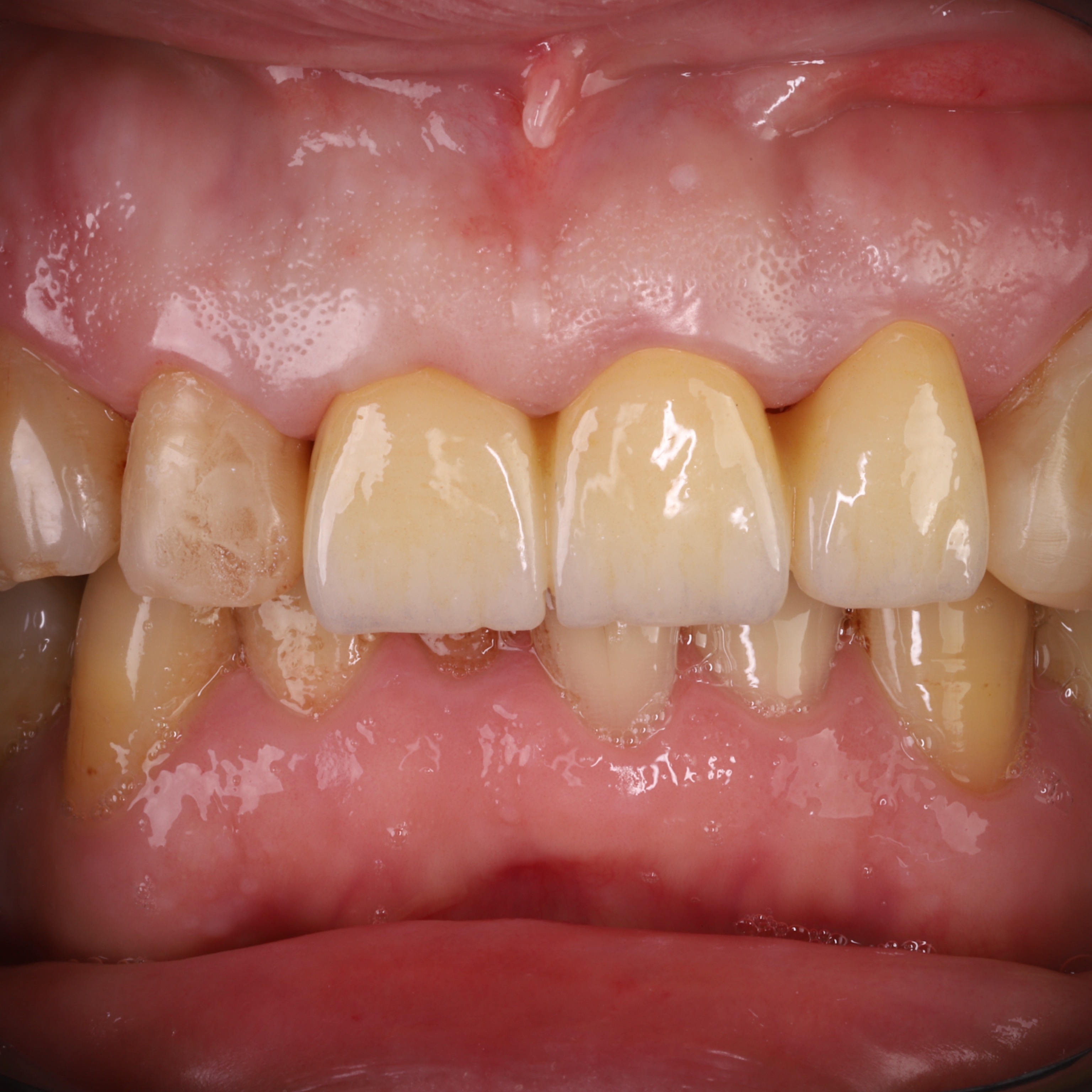 photo_after