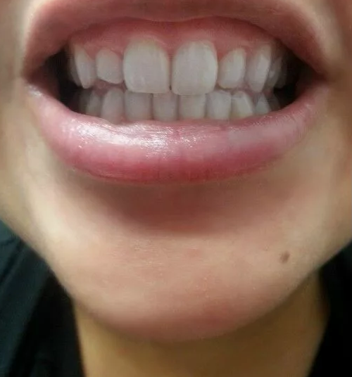 photo_before
