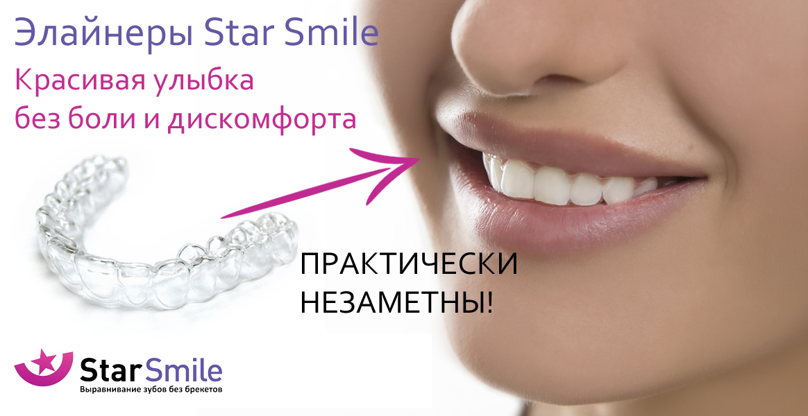 Star smile