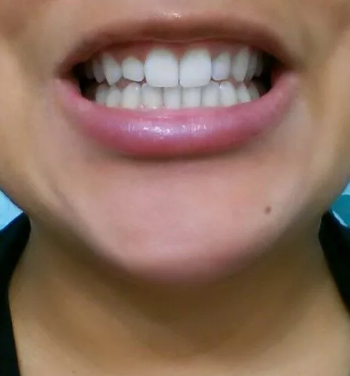 photo_after