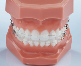 Брекеты Mistique (Dentsply GAC)