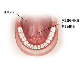 Подрезание уздечки языка