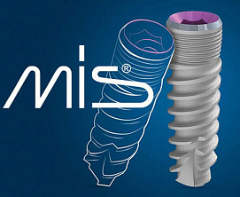Имплант MIS (Израиль)
