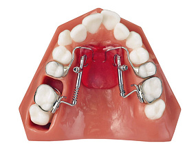 Аппарат Distal Jet